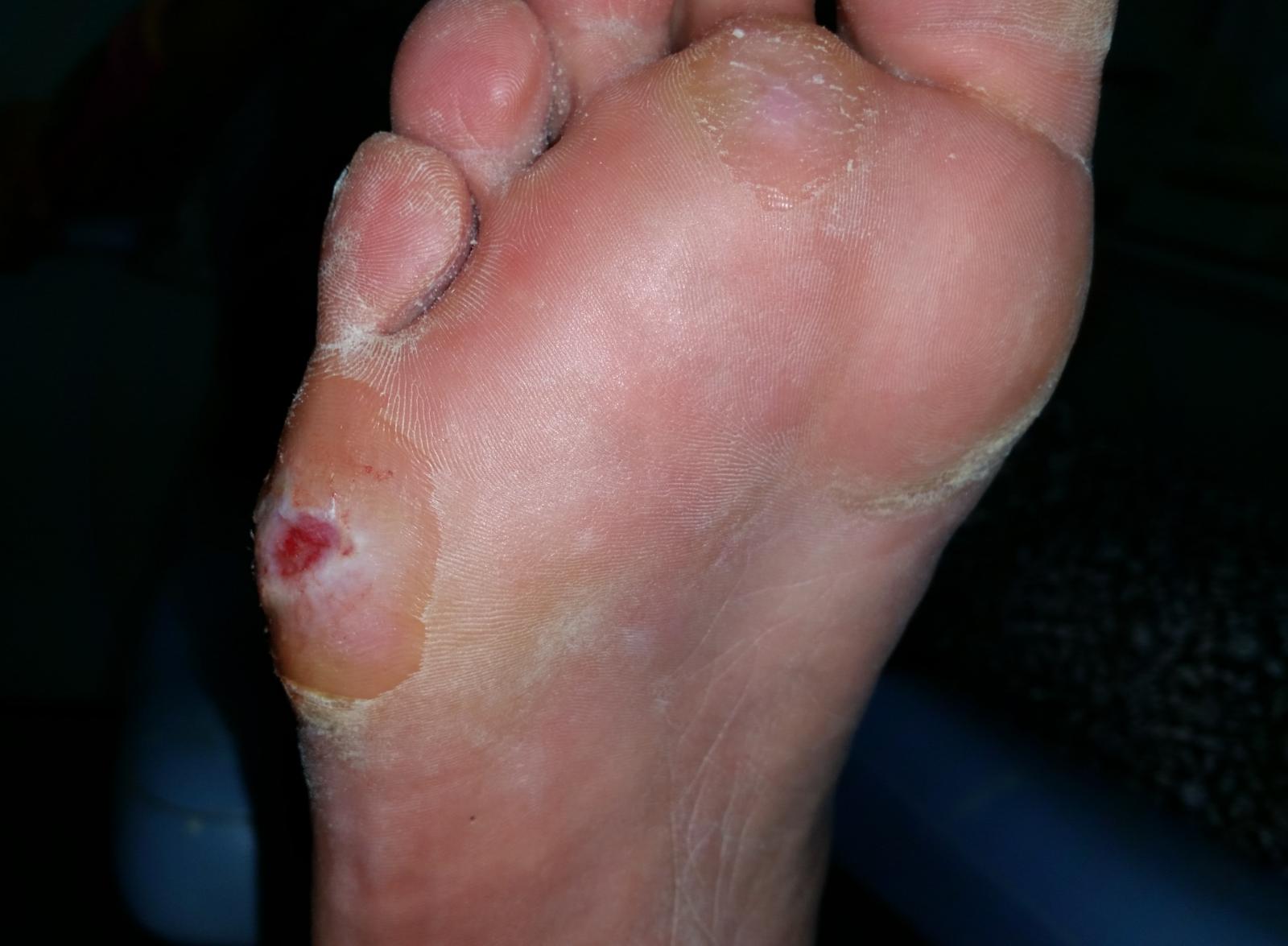 Podólogos de Castilla-La Mancha critica la formación ‘online’ impartida por la Junta a profesionales sanitarios para la prevención y manejo del pie diabético 2 Podólogos de Castilla-La Mancha critica la formación ‘online’ impartida por la Junta a profesionales sanitarios para la prevención y manejo del pie diabético 2