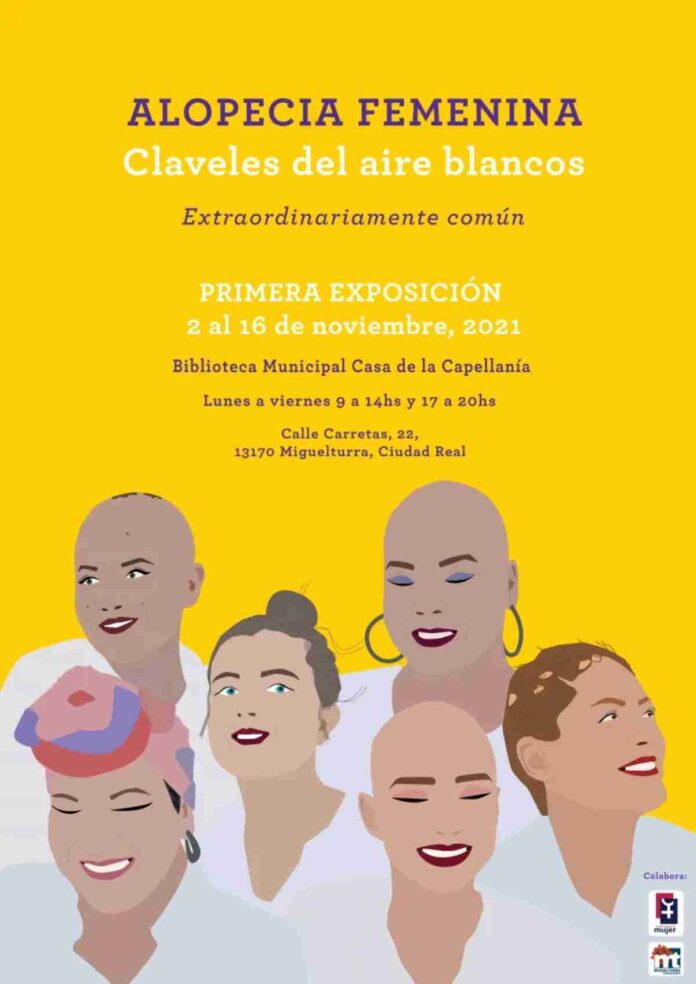 exposicioin-alopecia-femenina-miguelturra.jpg